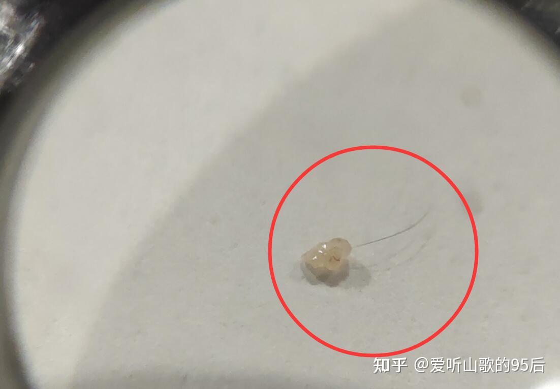 油脂粒显微镜图片