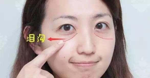 泪沟位置在哪 形成原因及消除方法介绍 - 知乎