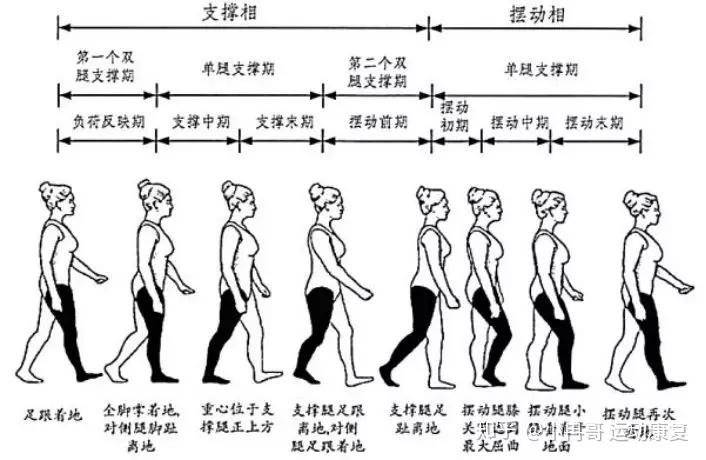 提髋型步态图片