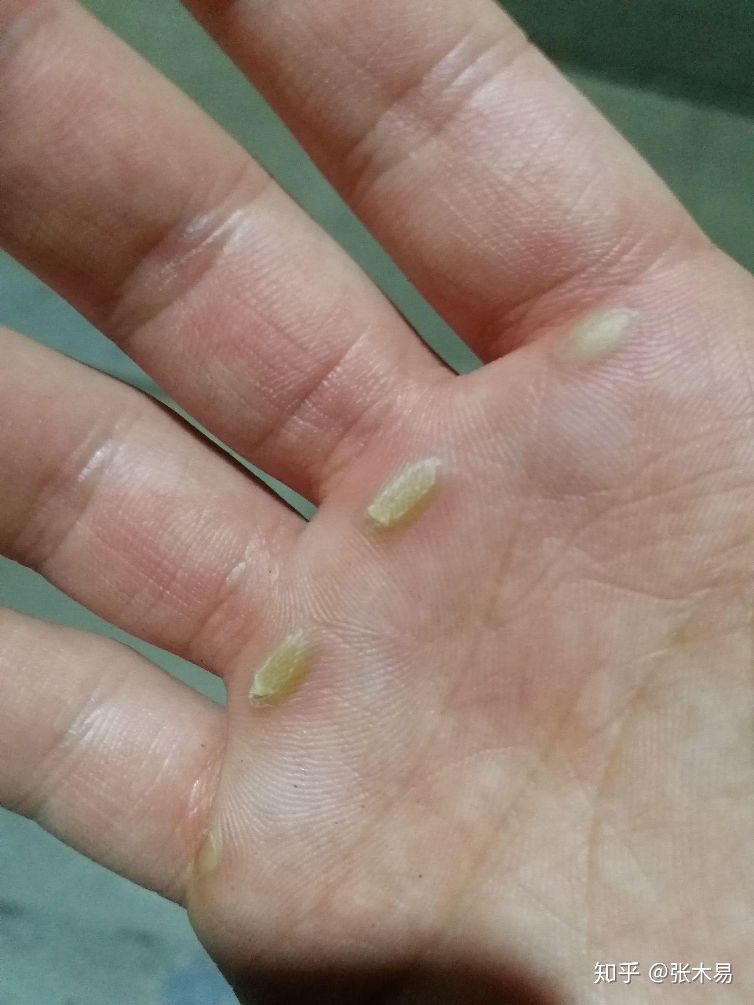 做引体向上时怎样避免双手起茧