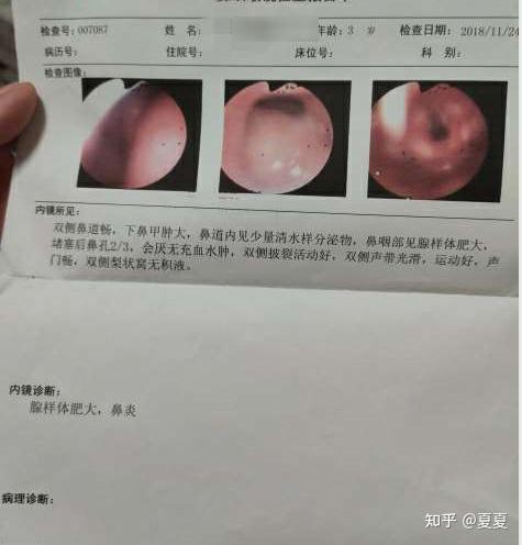 打开窗户让孤单透气