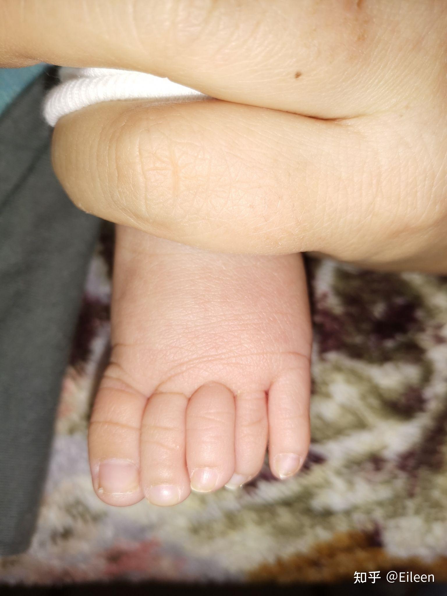 新生儿脚趾头图片图片