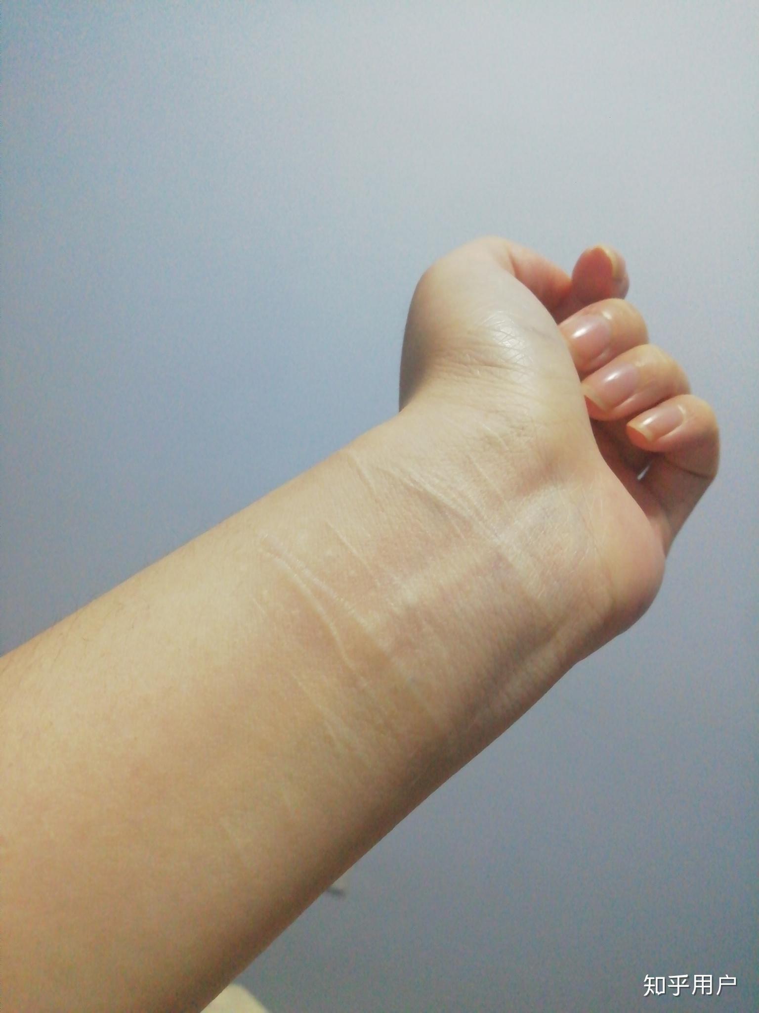 对于一个割腕过的人,未来如何向别人解释这道疤的由来? 