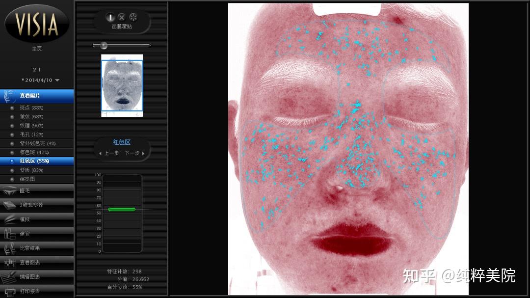 visia皮肤测试结果怎么看?