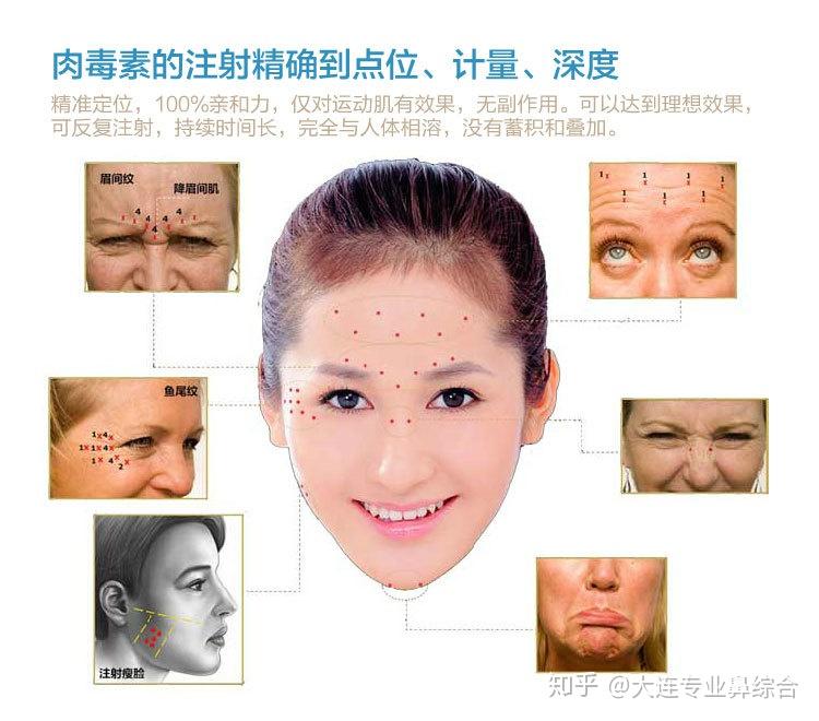 皱纹的形成 - 知乎