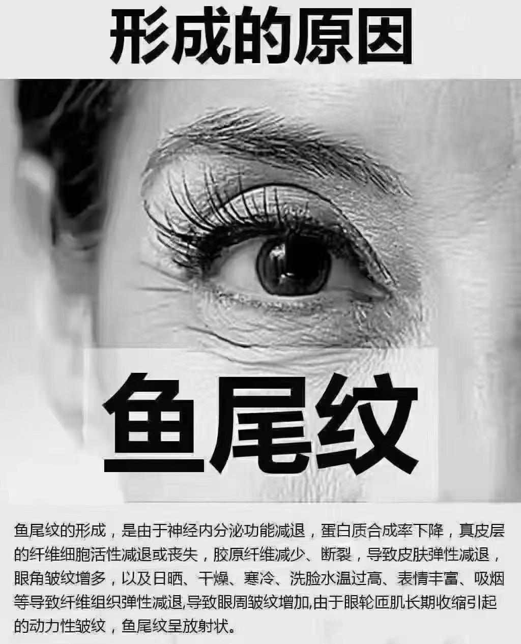 有效去除鱼尾纹|三,吃什么能有效去除鱼尾纹