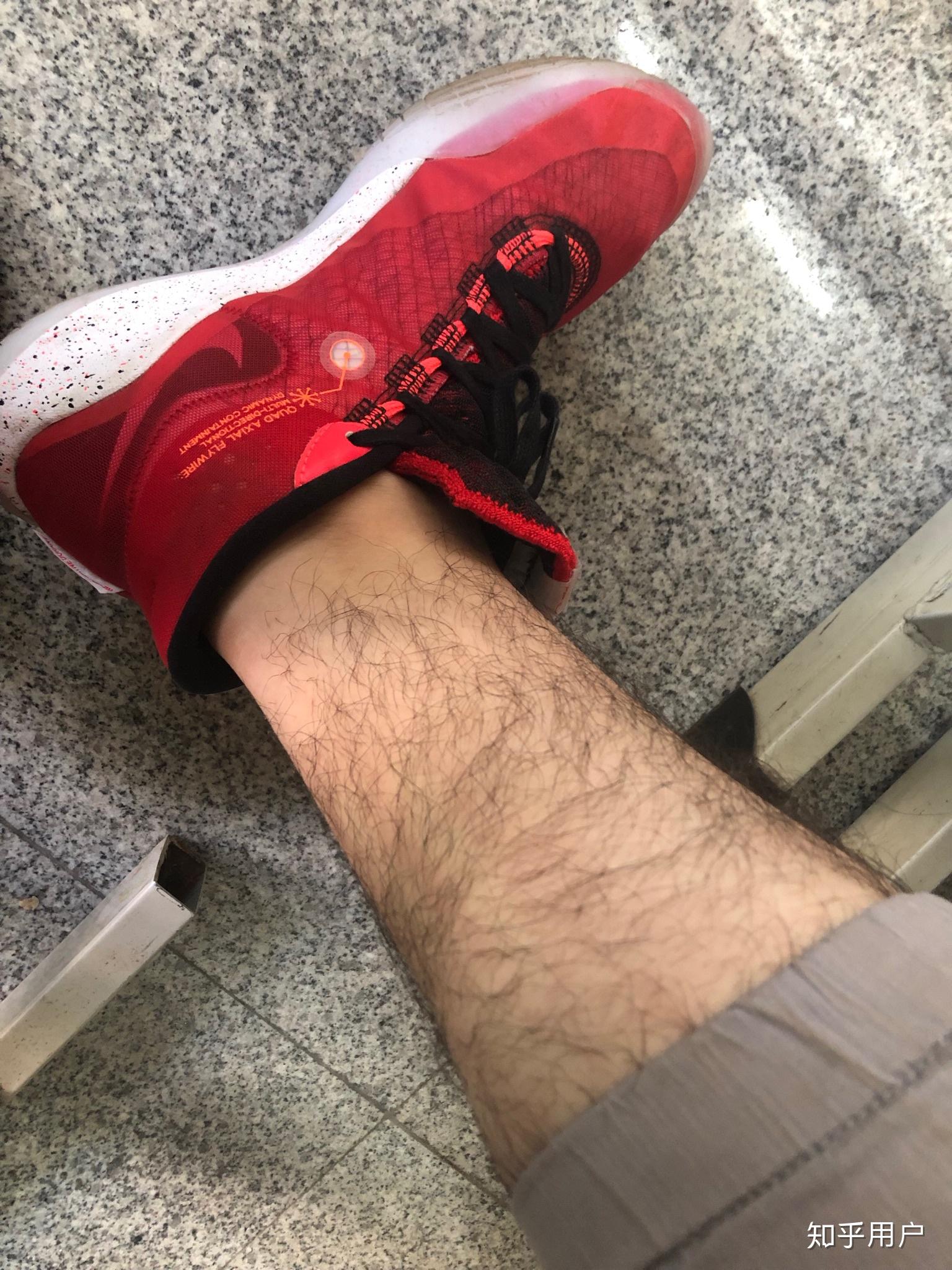 女生也长腿毛吗?