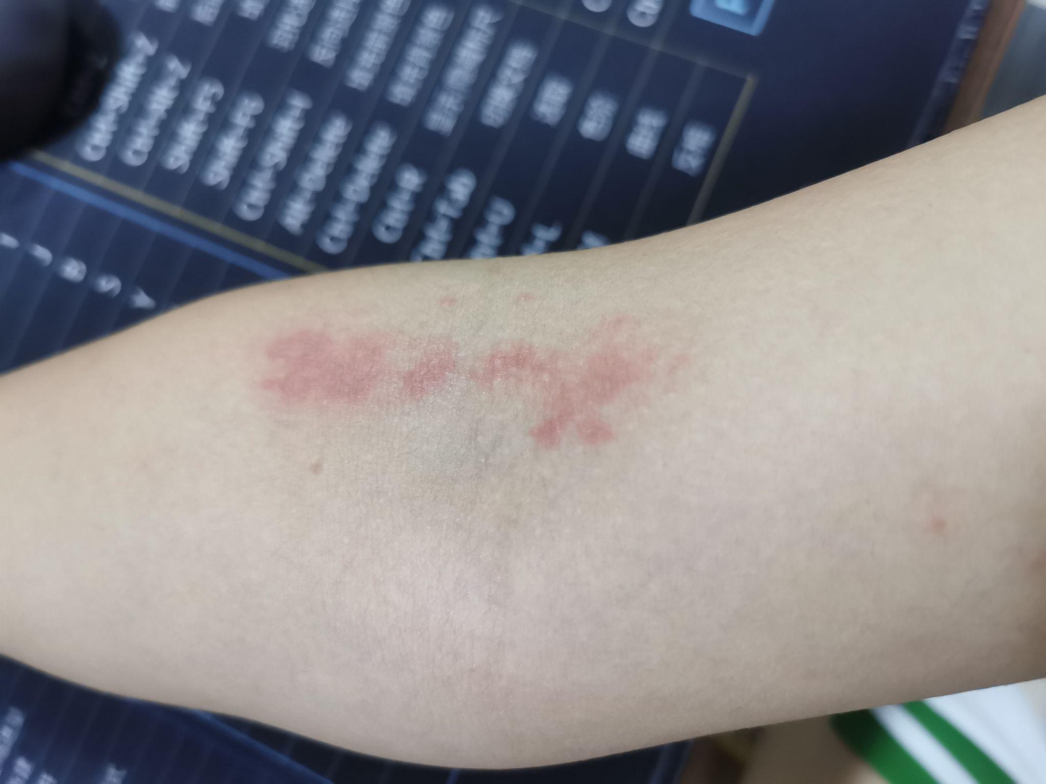 蜘蛛撒尿是什么样子的