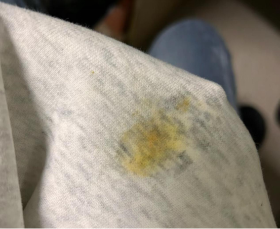 冬天的时候油渍弄到厚外套上了怎么洗干净啊?最好是不用洗整件衣服的办法!教你一招,顽固油渍也能轻松拿下!