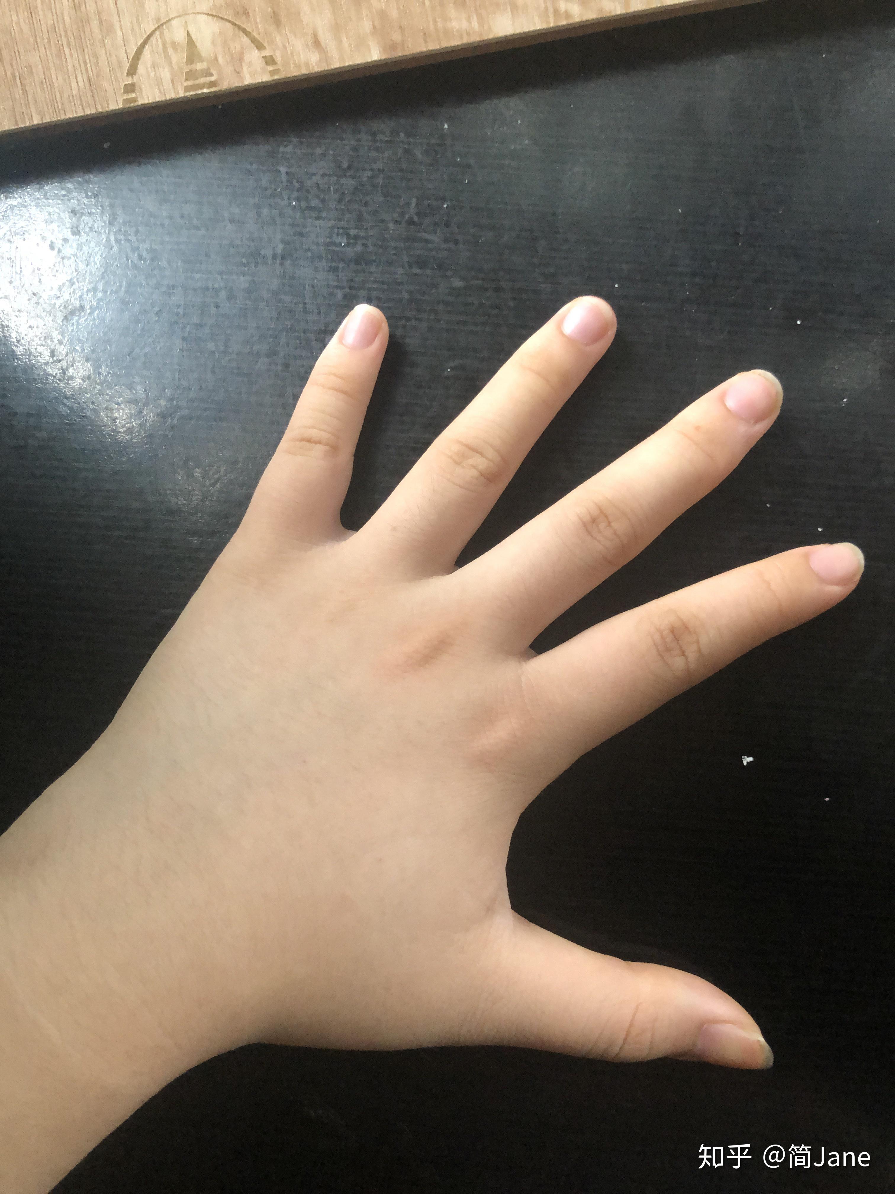 女生有波兰氏综合症是不是很悲哀? - 知乎