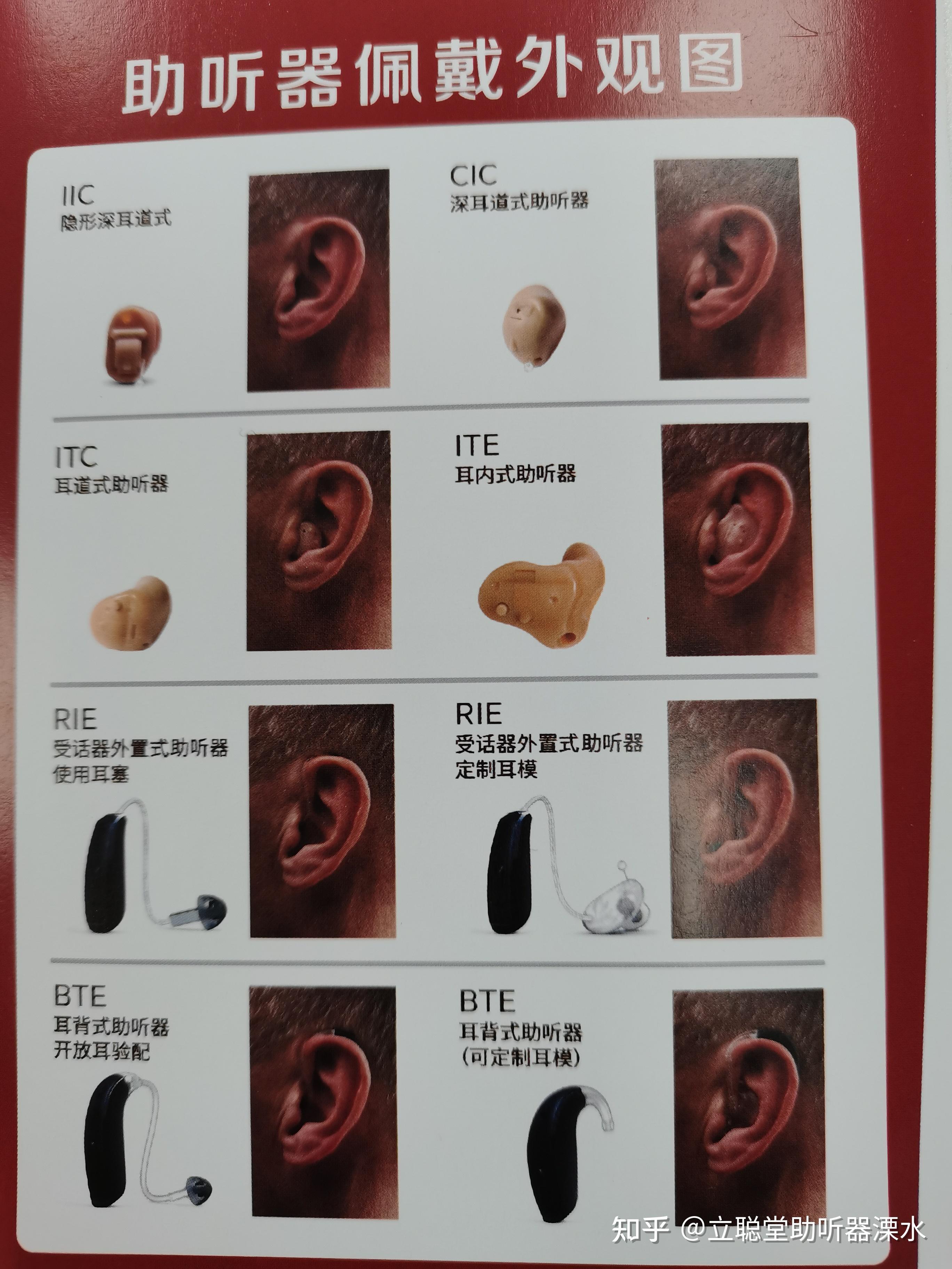 听力损失分级标准 - 知乎