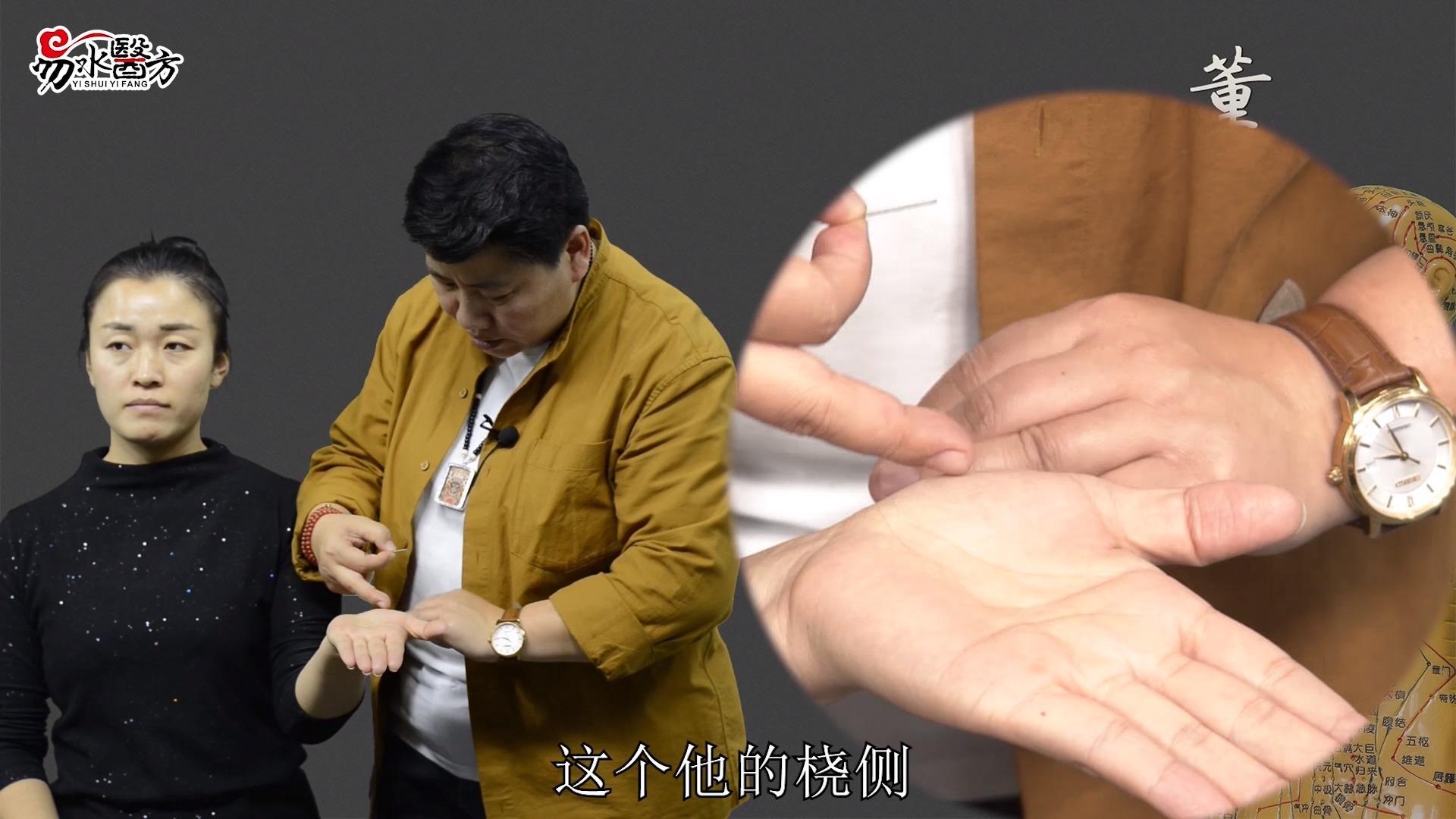 周志军:董氏奇穴治失眠有奇效