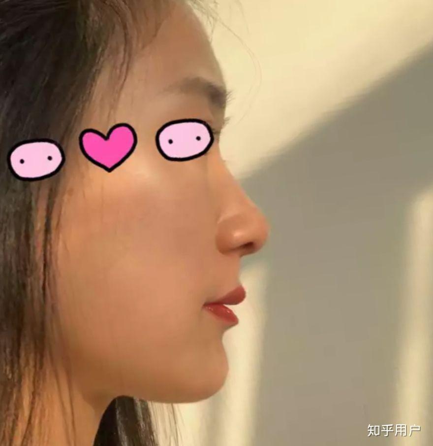 请问我是鼻基底凹陷还是嘴凸? - 知乎