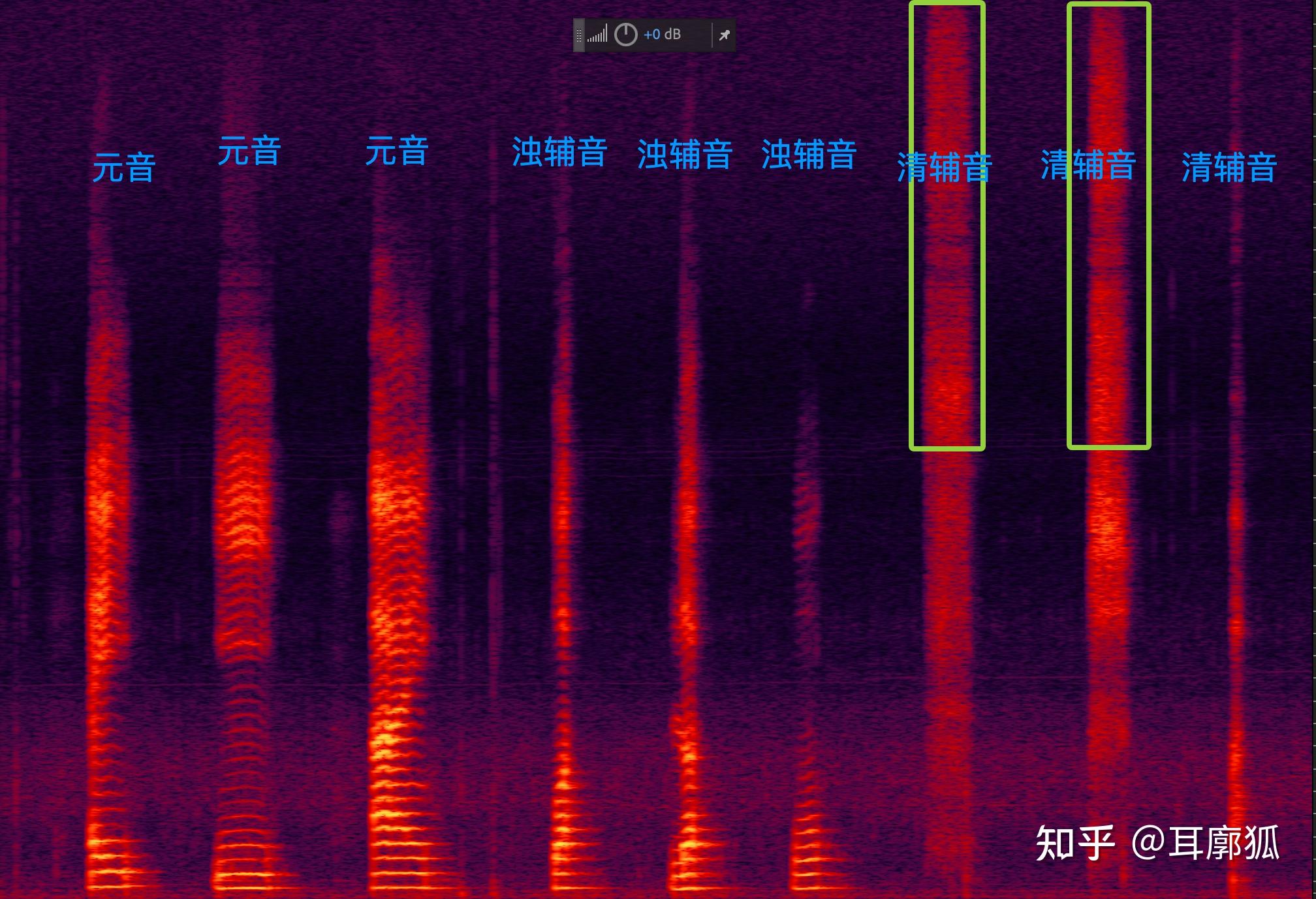 听力好 但听不清别人说话是为什么呀? - 知乎