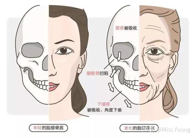 为什么现在很多人20多岁脸就垮了? - 知乎