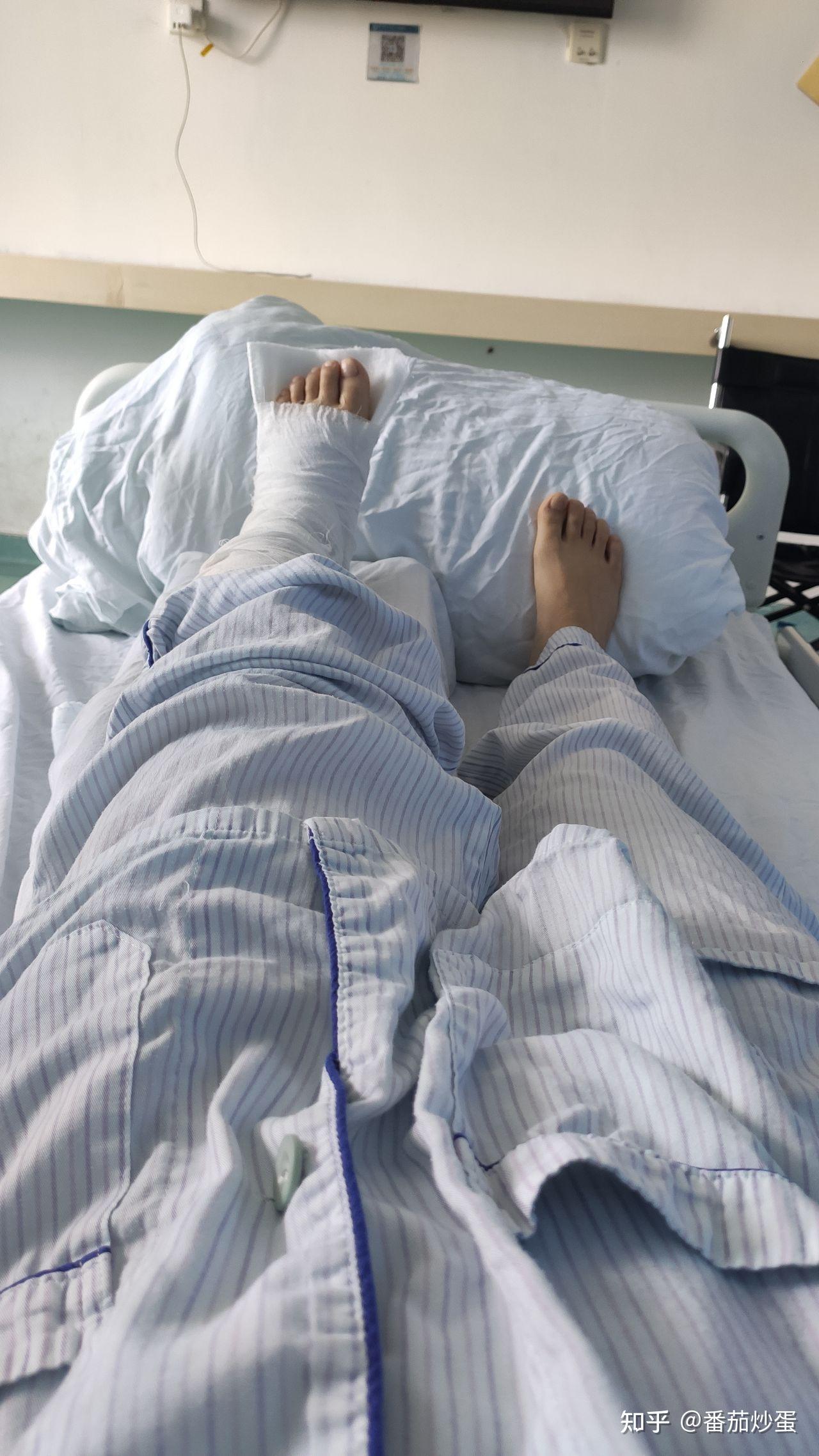 血淋淋的教训,关于被电动车撞脚踝骨折不及时报警的血史 - 知乎