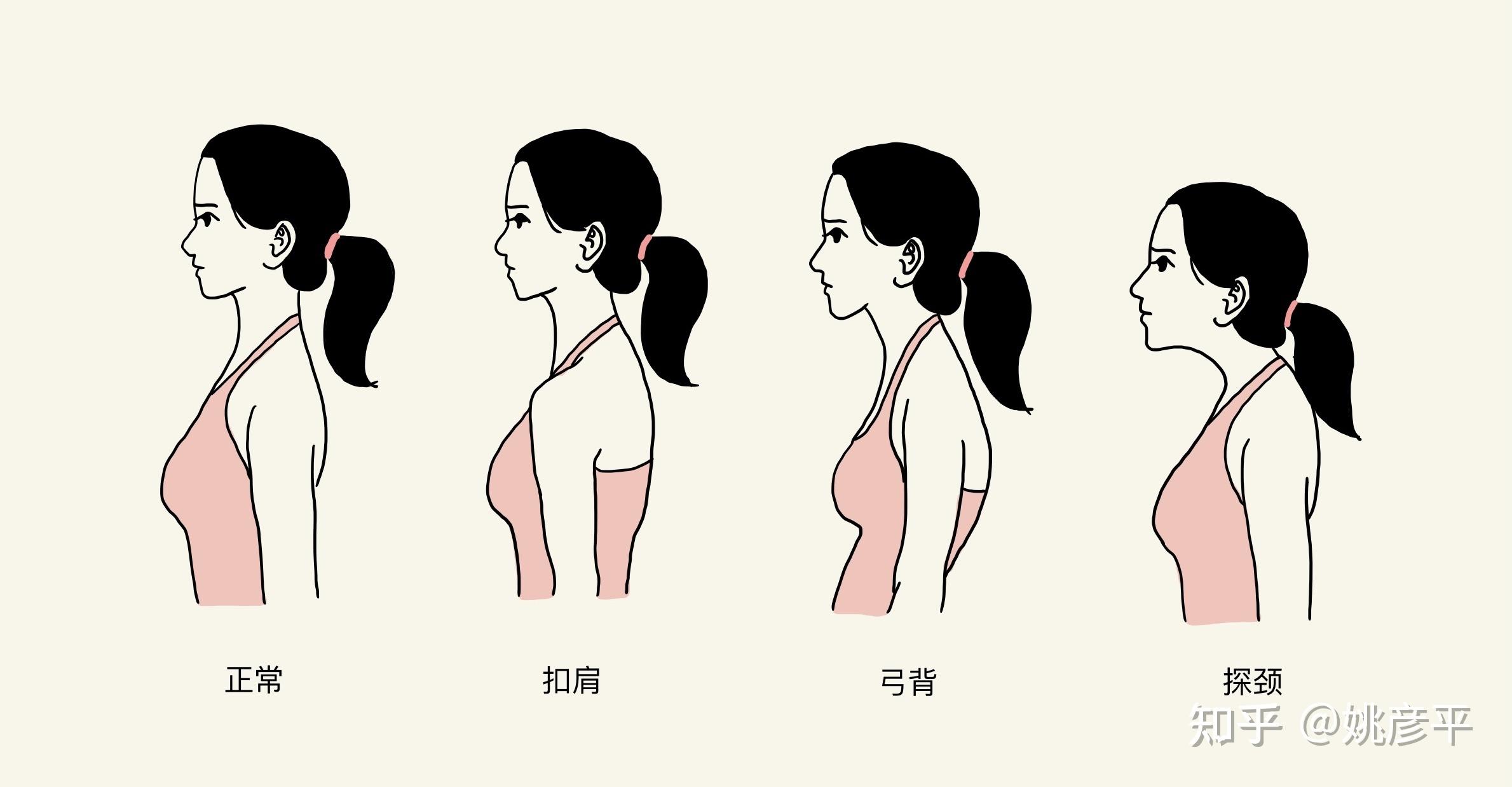 探索瑜伽理疗的秘密 如何修复肩颈