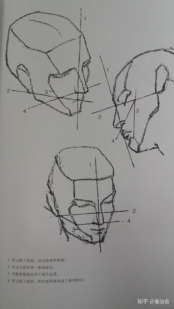 关于伯里曼头部构造四条线看不懂