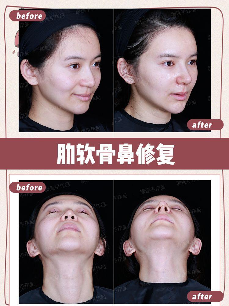 鼻底的美学 - 知乎