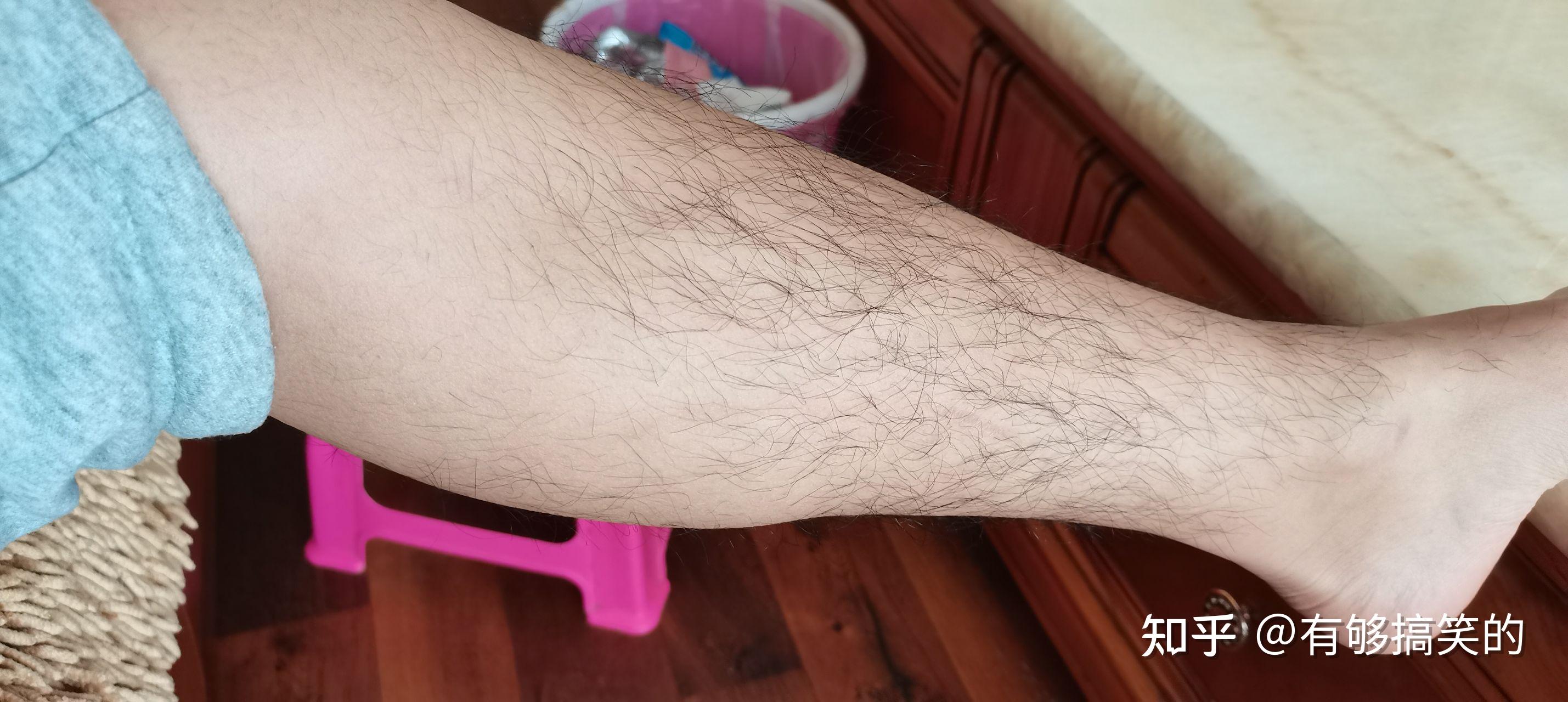 男生腿毛多适合穿短裤吗?