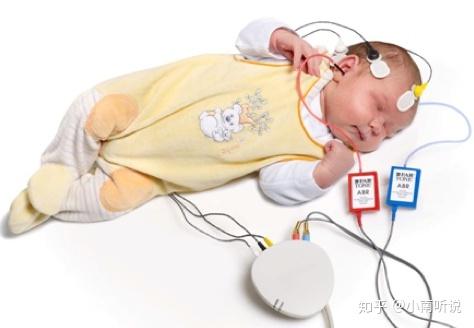 新生儿听力筛查机器的原理是什么