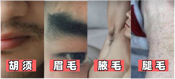 可以用体毛植发吗？ - 知乎
