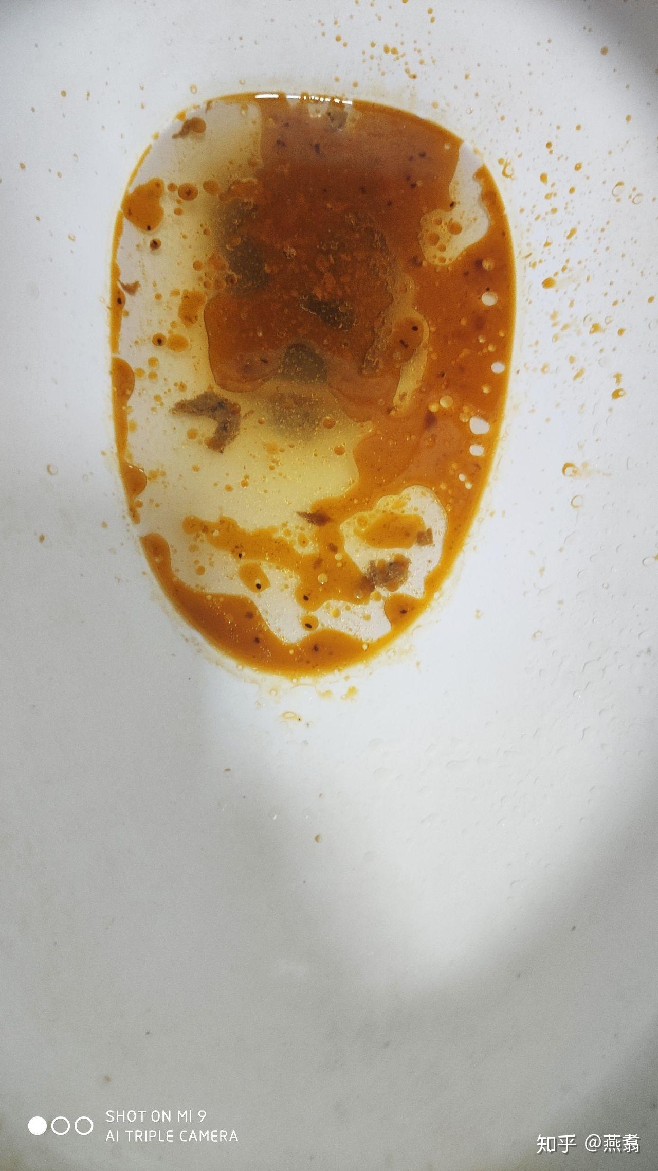 到底有没有真正有效的减肥产品?请吃过真的瘦了的良心回答?