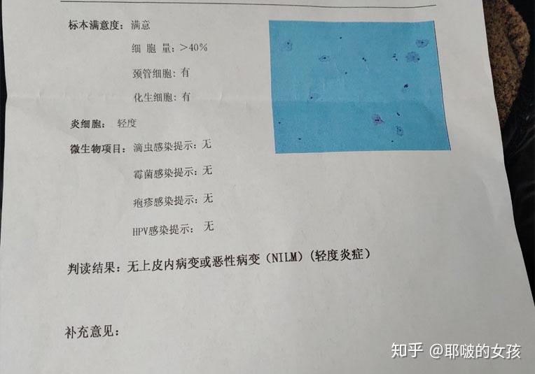 阴道镜结果是转化区类型三型,鳞柱交界不可见