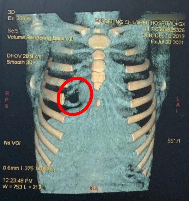 伤在娃身痛在娘心经纪人与高端医疗的第一次密接