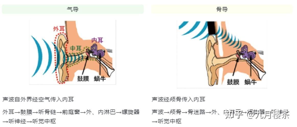 运动耳机刚需款｜园世X7骨传导耳机实测