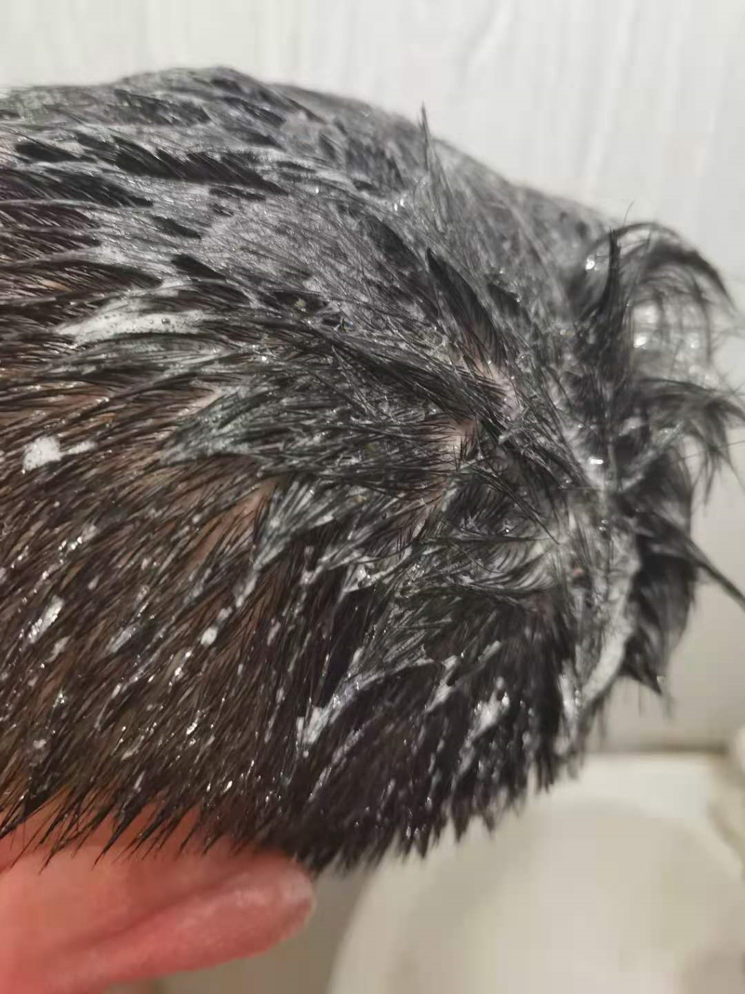 大块大块地掉头皮屑有什么好用的男士去屑洗发水推荐