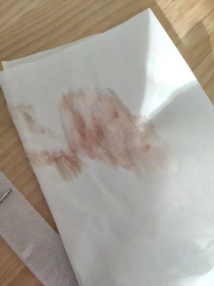 卫生纸吐血图片图片