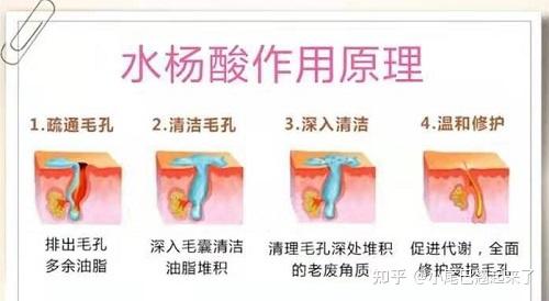 脸上痘痘反反复复怎么调 v2-3f3e5d3cc9a49761cd042336868d1dfc_r.jpg