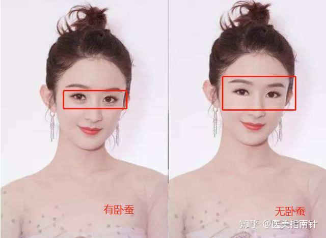 有没有什么办法可以让脸部提升 v2-3f451b88710b04170fced8f63d032520_r.jpg