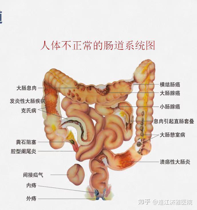 肠道水疗的工作原理是怎样的