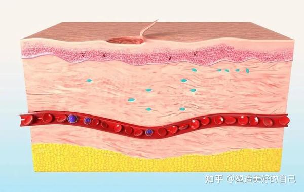 出现脓液或视力受损