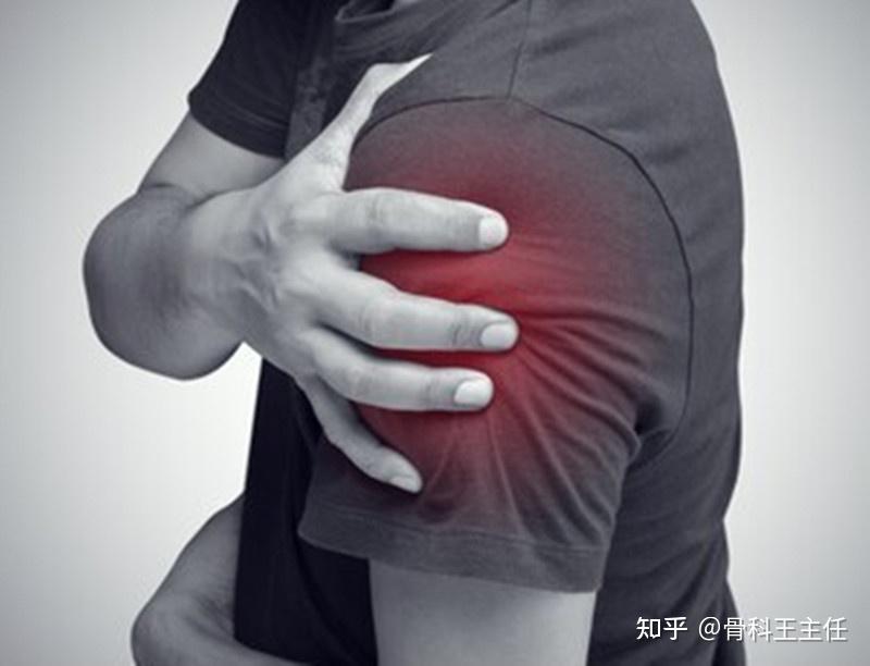 睡觉时肩膀疼:滑囊炎,肌腱炎,肩袖撕裂? - 知乎