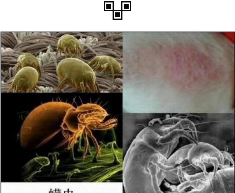 你一定不知道普通毛巾上的螨虫是怎样伤害宝宝的皮肤的