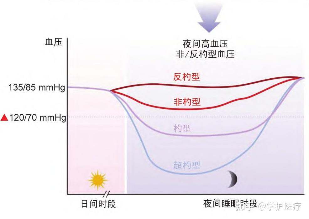 24 h動態血壓監測,將血壓的波動曲線分為4種形態,即杓型(夜間平均血壓