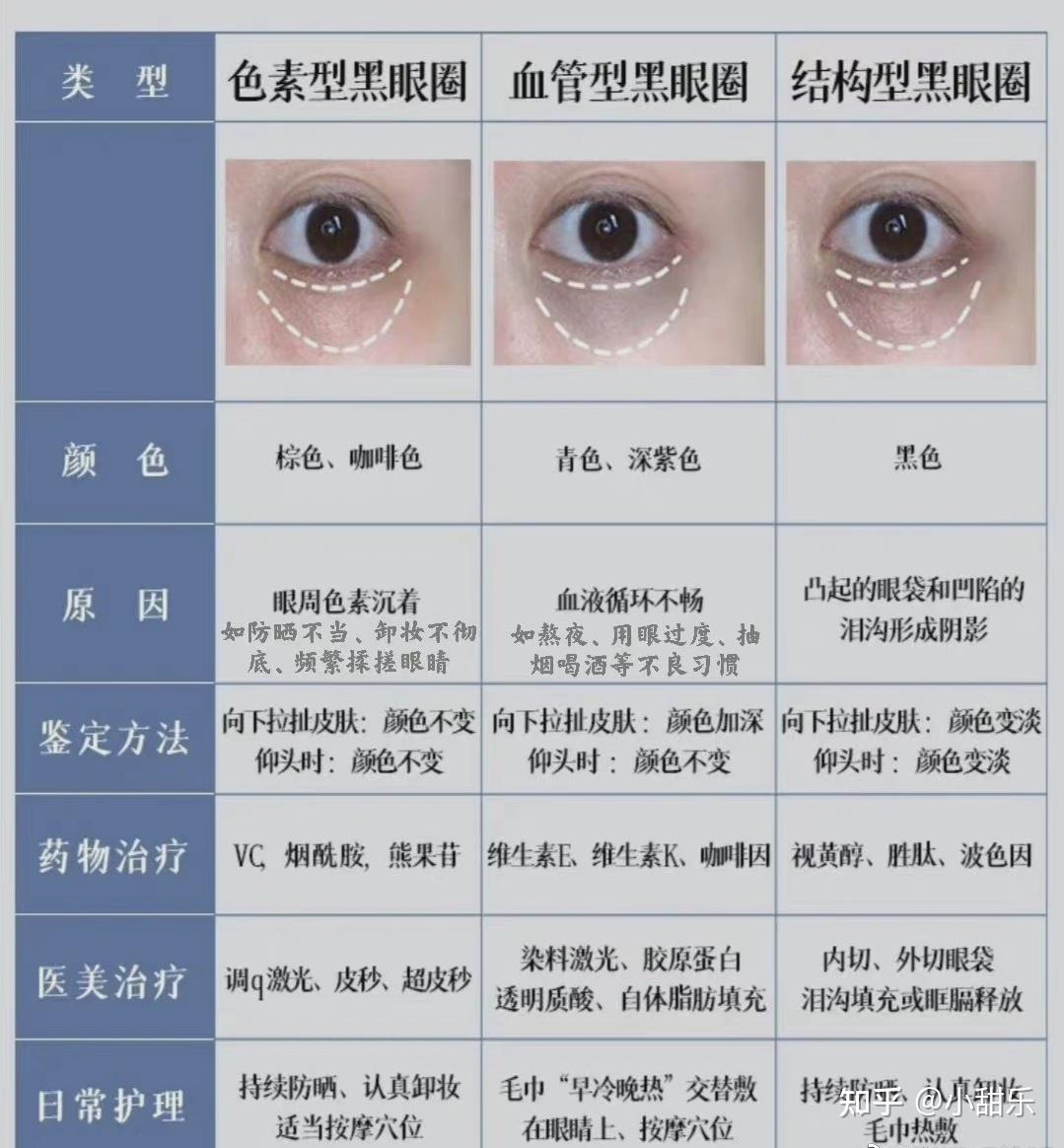 色素型黑眼圈:黑色素多,原因与没做好防晒,卸眼妆不到位有关系血管性