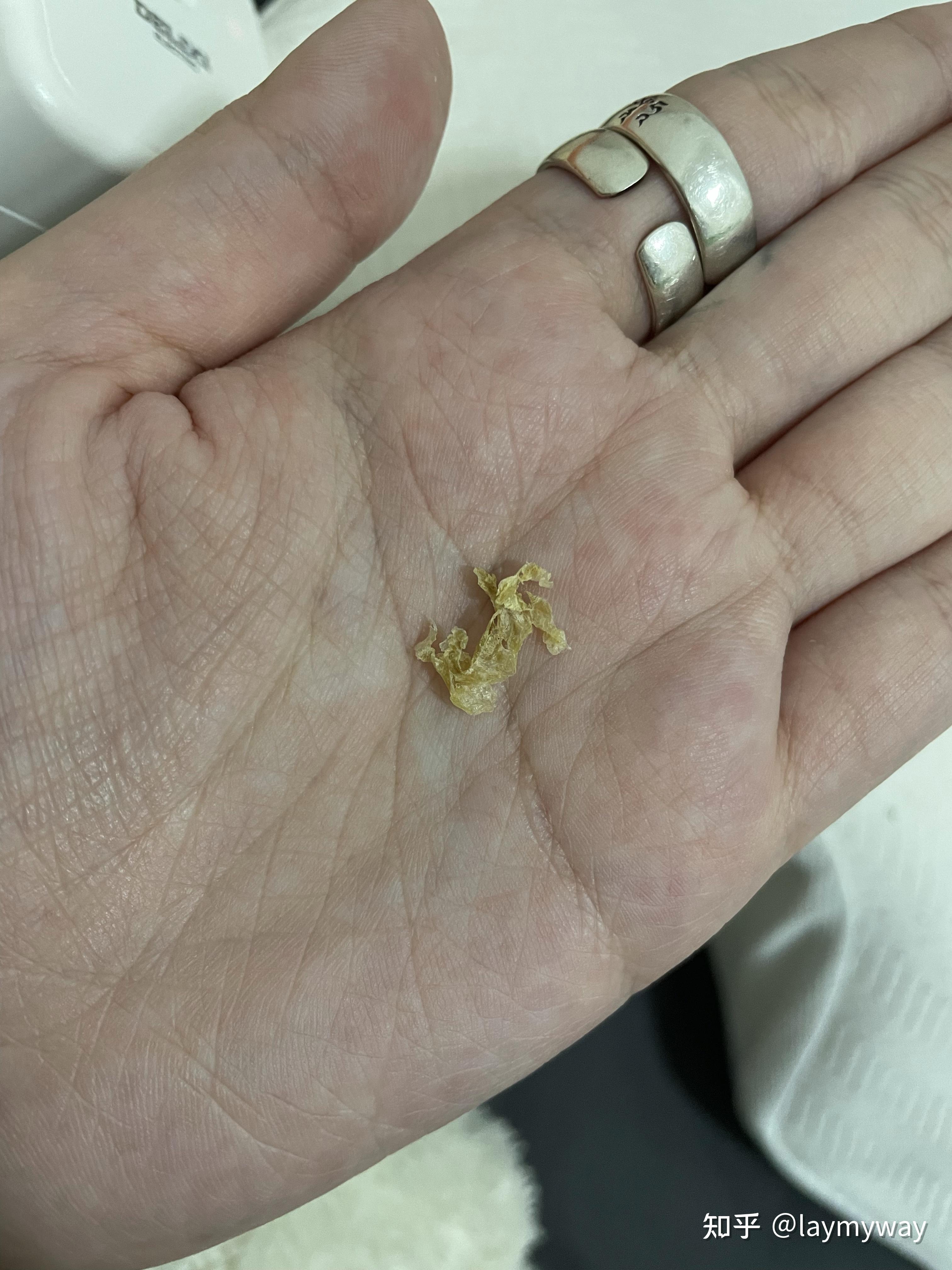 掏出一块超大耳屎,是种什么体验? - 知乎