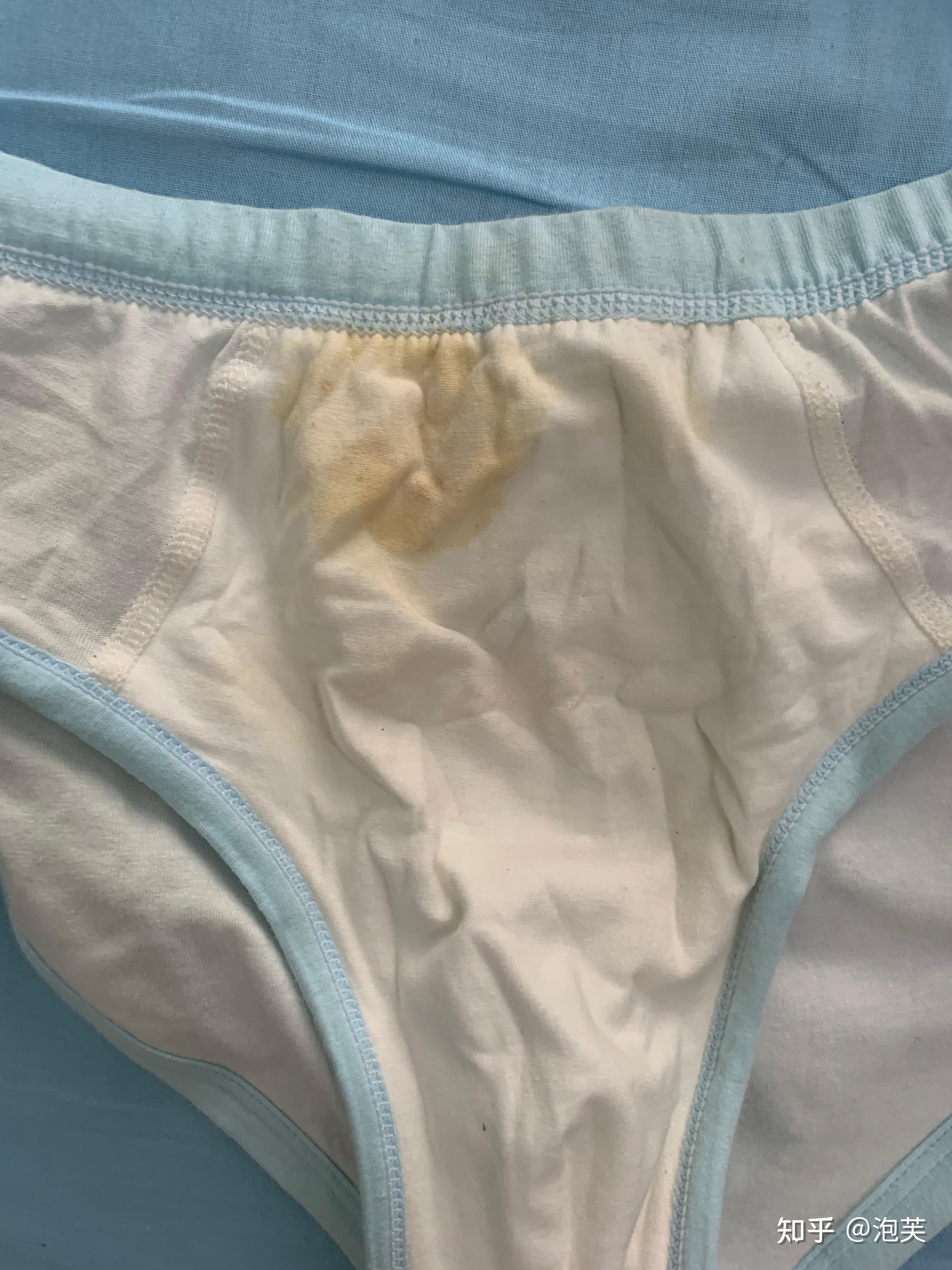 12岁遗精怎么办(发黄)?