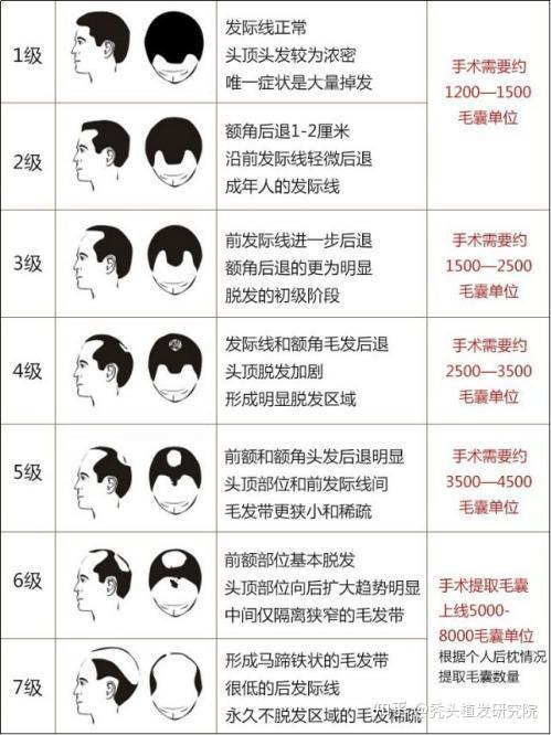 植发医院行业趋势：郑州风头正盛