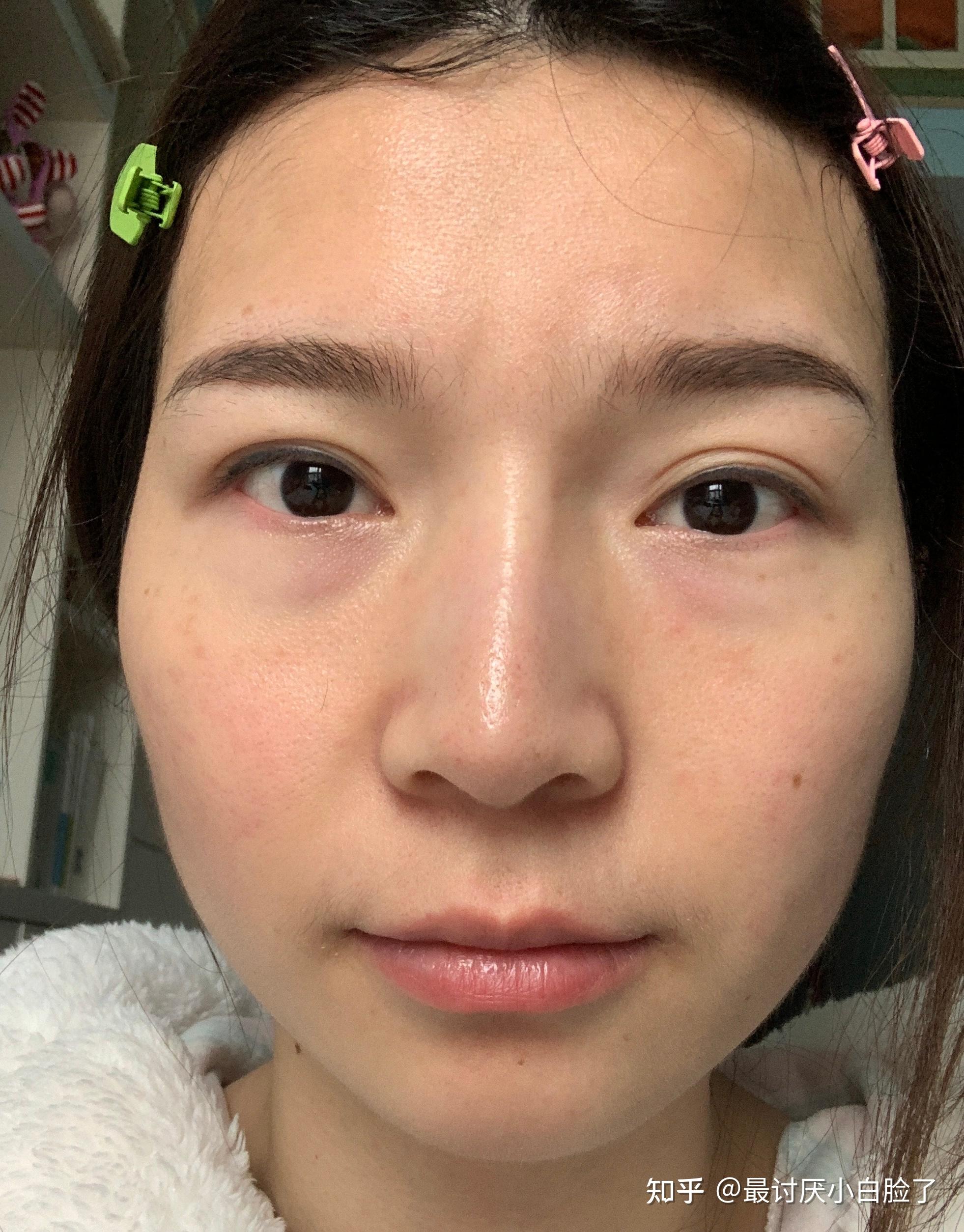 想请问一下各位大佬,我长这样应该怎么改变自己,感觉