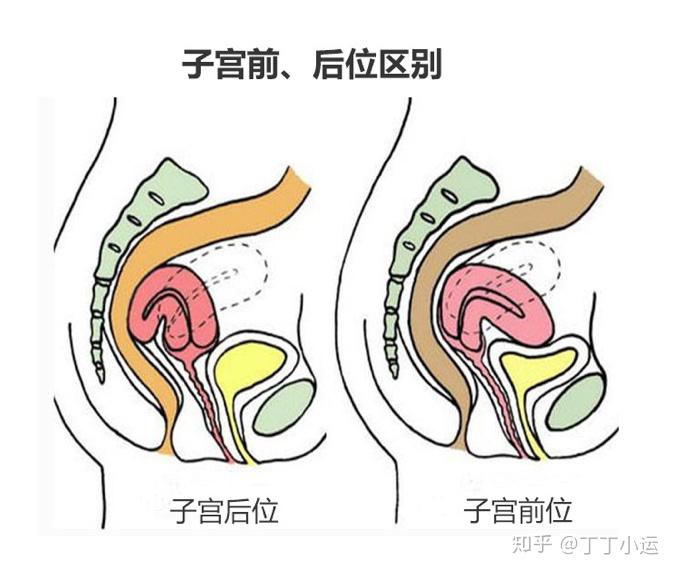 子宫前位受孕技巧图片