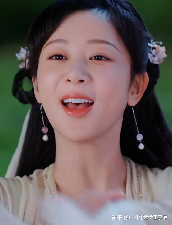 杨紫真的没整容吗? - 知乎