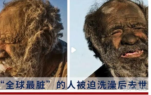 95后女孩从造价工程师转行家政私厨与"全球最脏的人"洗澡后病亡