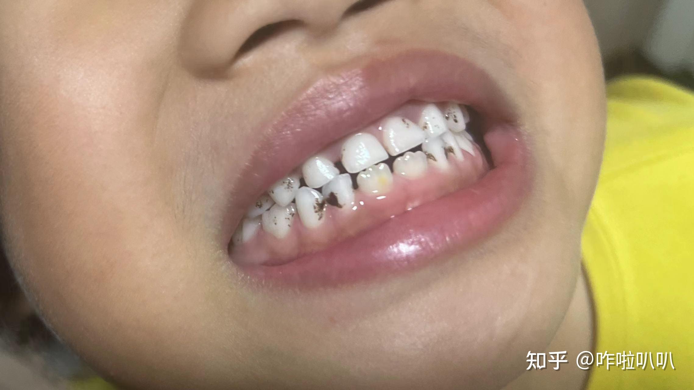 案例分享 | 俊美牙醫診所 Chunmei Dental Clinic
