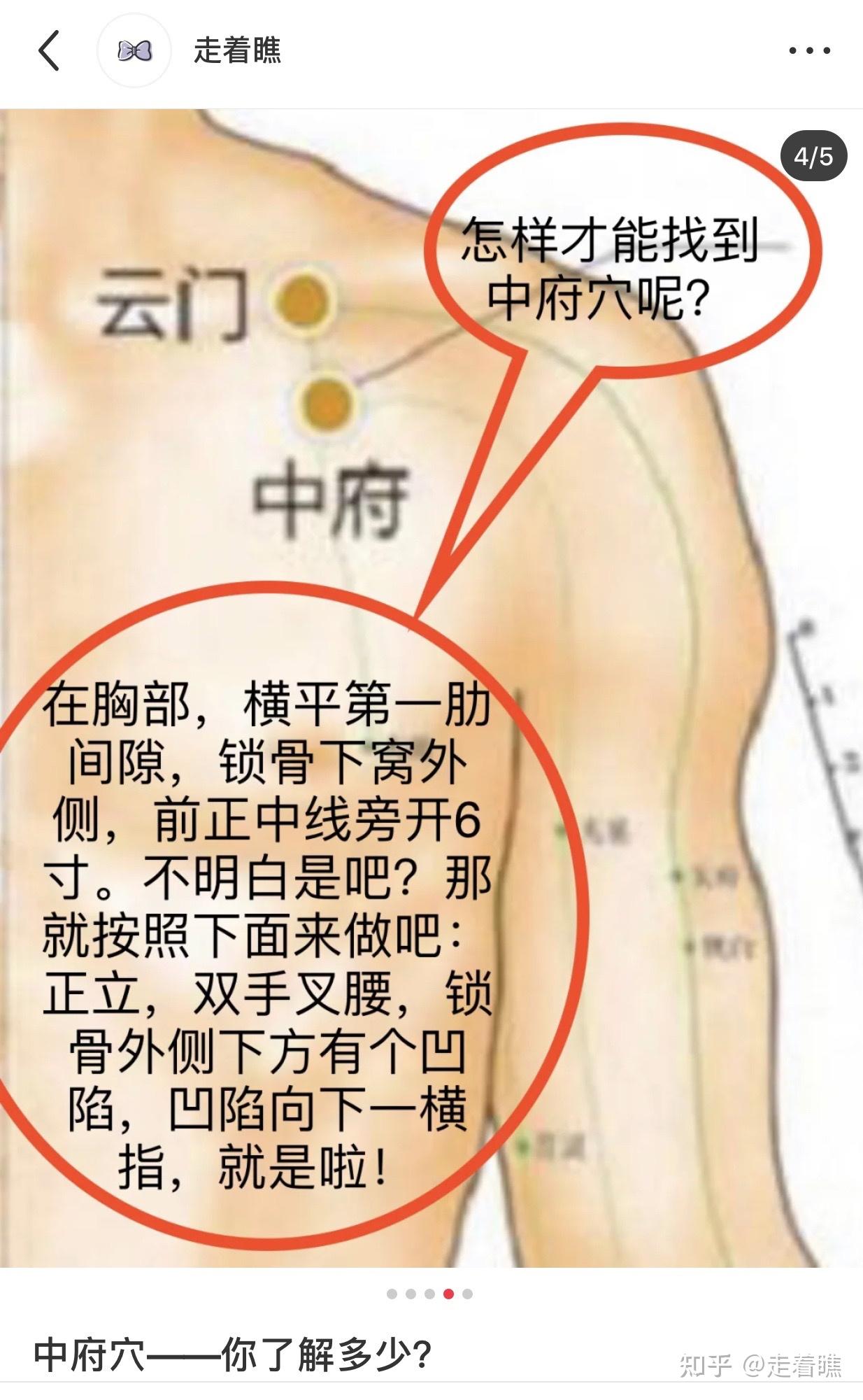 中府穴——你了解多少?