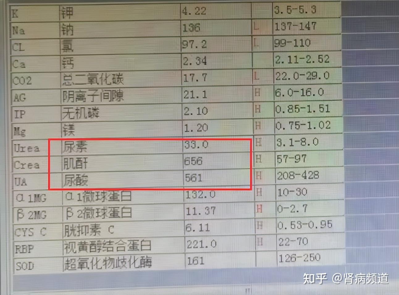 肌酐99图片